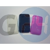 St21i xperia tipo átlátszó szilikontok Xperia Tipo  E002256